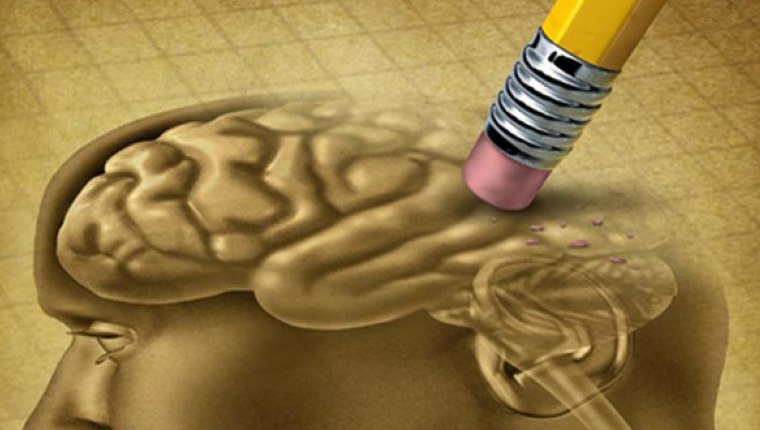 Alzheimer hastalığı erken teşhis edilebilecek