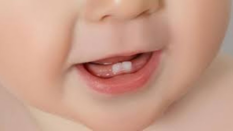 Bebeklerde diş çıkarma belirtileri