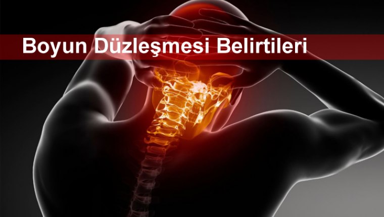 Boyun Düzleşmesi