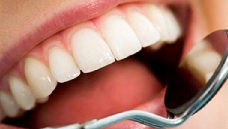 Diş sağlığı yazın daha bir önemli