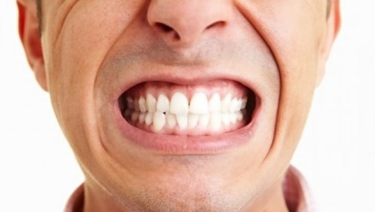 Dişinizi gıcırdatıyorsanız hasta olabilirsiniz