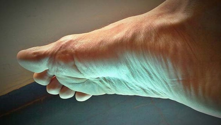 Diyabet hastalarının ayak sağlığı için 10 öneri