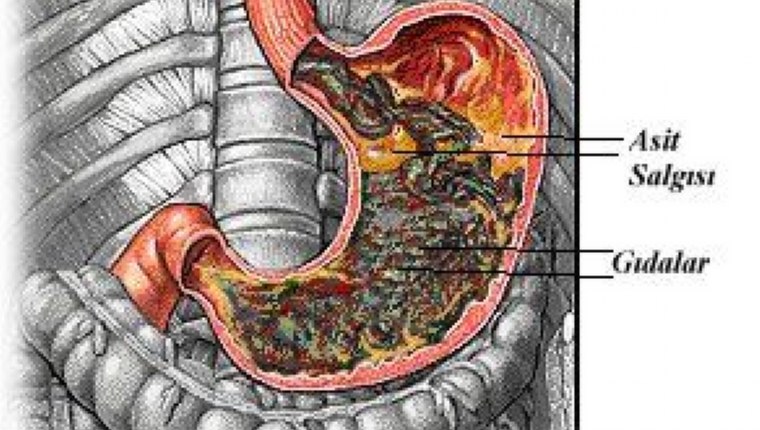 İnatçı gastritler kanser olabilir