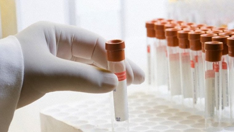 Tek testle 13 farklı kanser türü teşhis edilebilecek